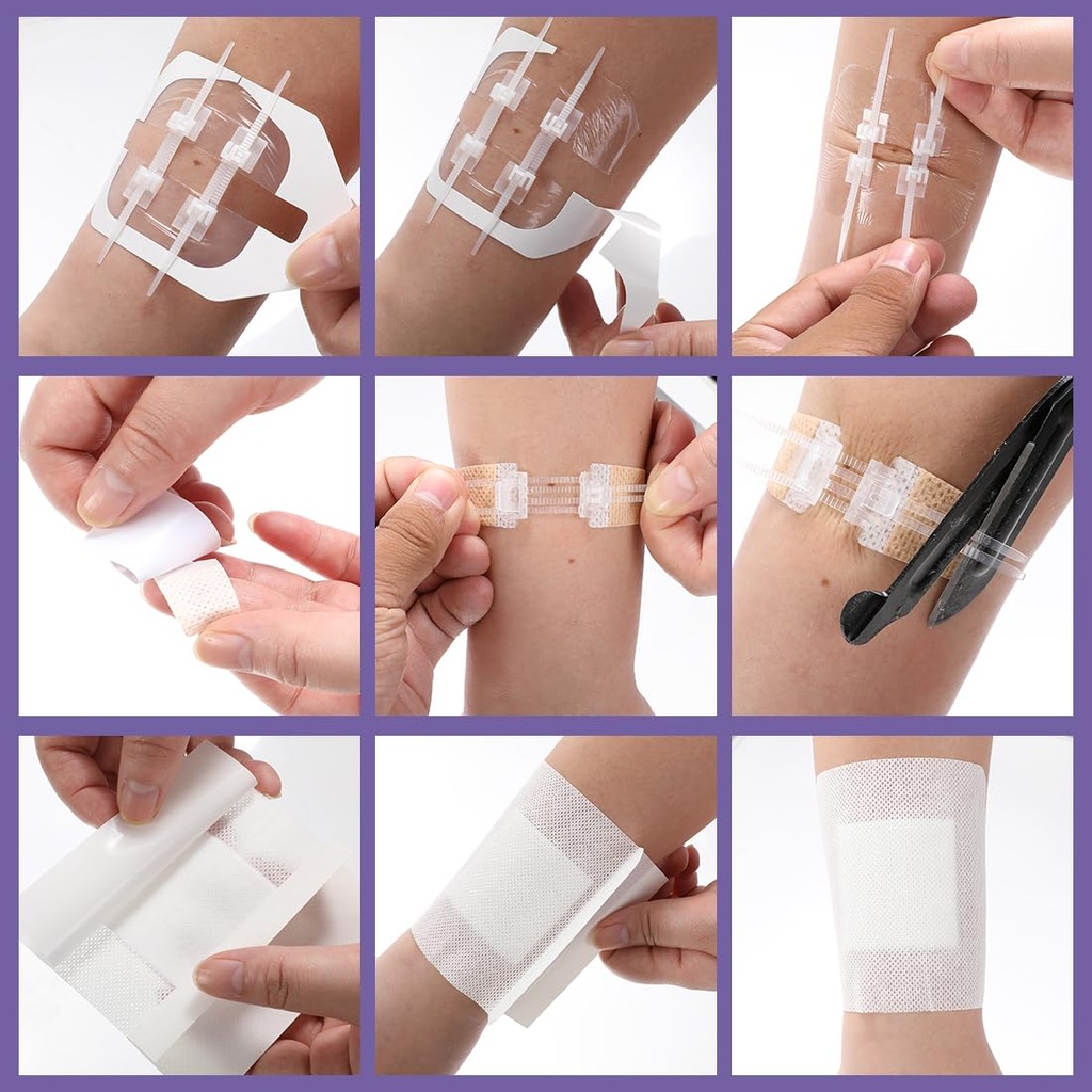 zip-stitch-13-pack-wound-closure-strip-3-3.jpg