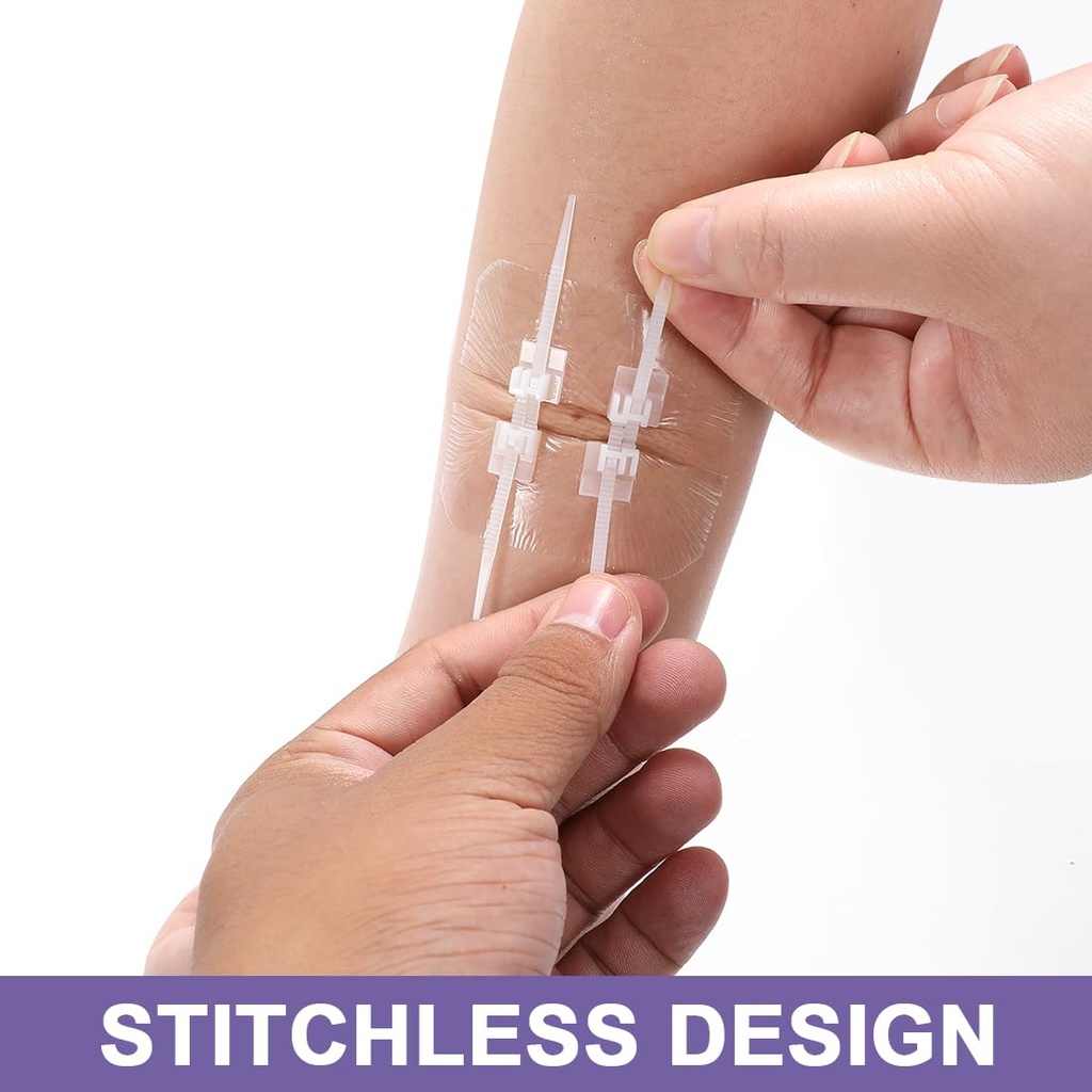 zip-stitch-13-pack-wound-closure-strip-3-4.jpg