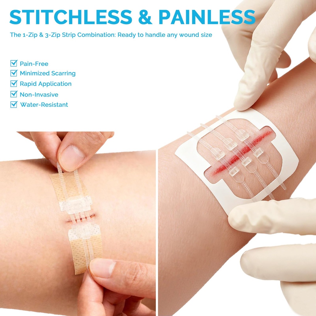 greetmed-emergency-wound-closure-strips--3.jpg