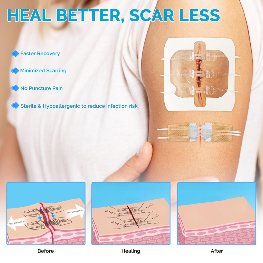 greetmed-emergency-wound-closure-strips--5.jpg