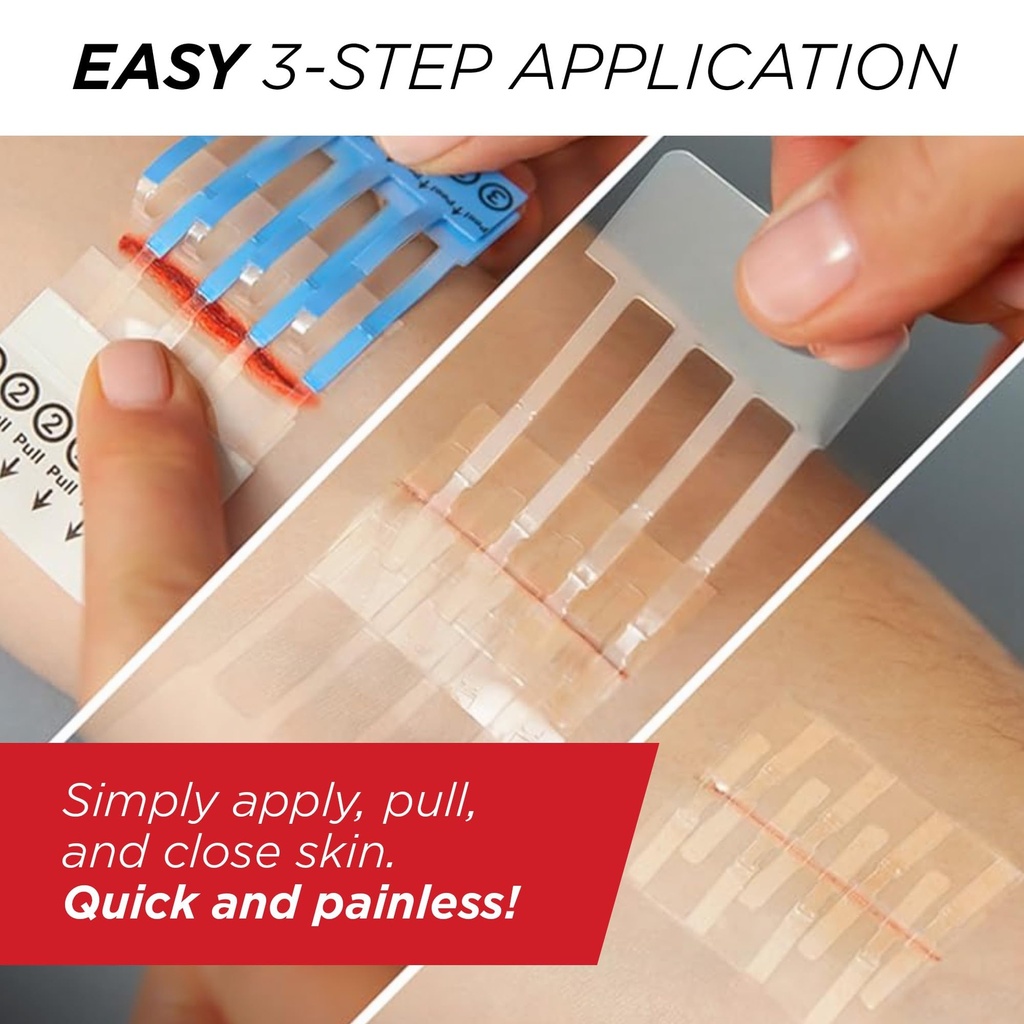 clozex-emergency-laceration-closure-kit--5.jpg