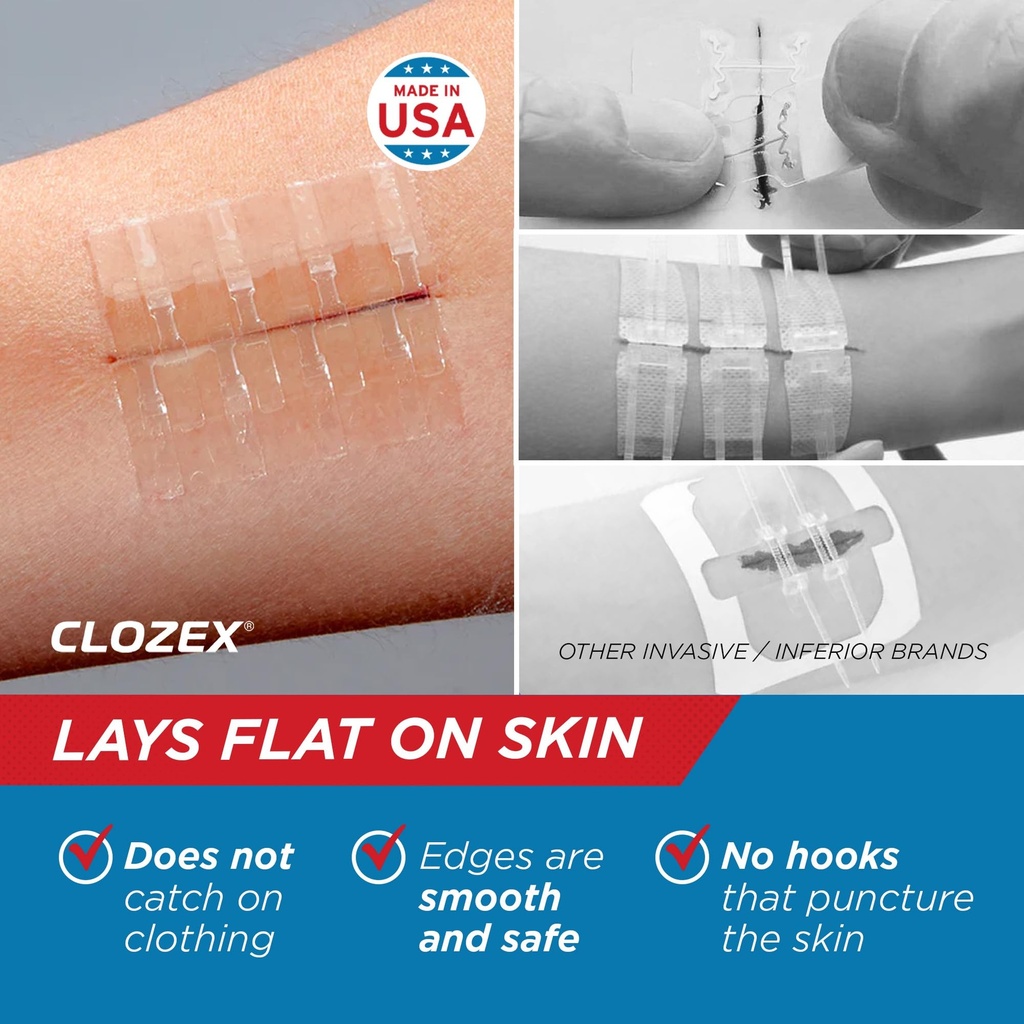 clozex-emergency-laceration-closure-kit--4.jpg