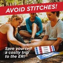 clozex-emergency-laceration-closure-kit--2.jpg