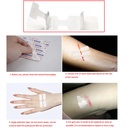 10-pack-wound-closure-strips-non-stitch--4.jpg