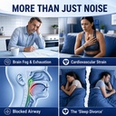 anti-snoring-spray-gentle-snoring-soluti-3.jpg