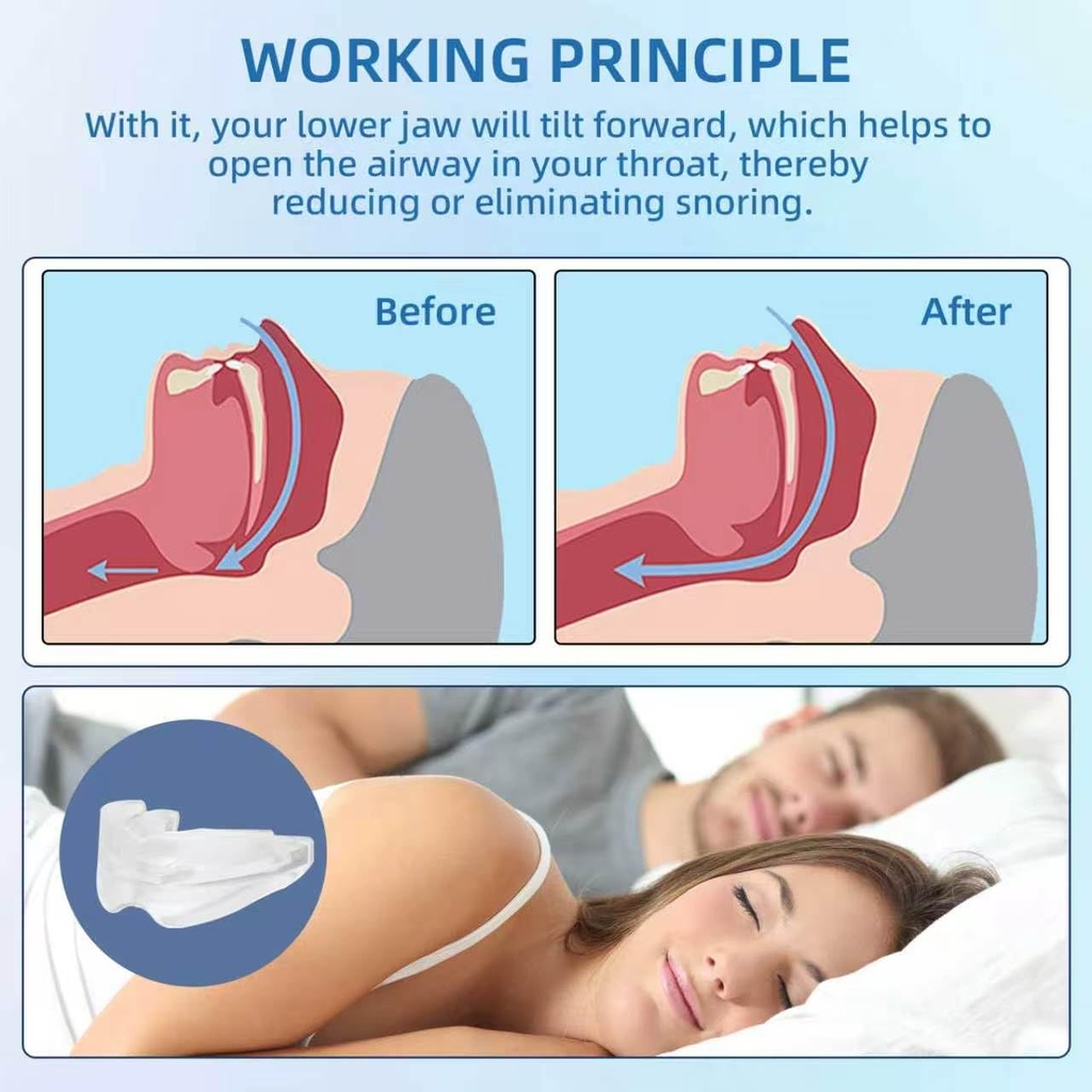 anti-snore-mouthpiece-adjustable-mouth-g-4.jpg