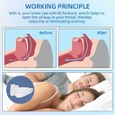 anti-snore-mouthpiece-adjustable-mouth-g-4.jpg