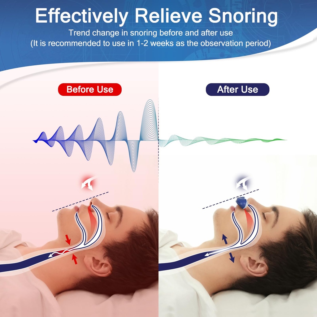 anti-snore-device-stop-snoring-reduction-2.jpg