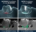 puresleep-the-original-anti-snoring-mout-3.jpg