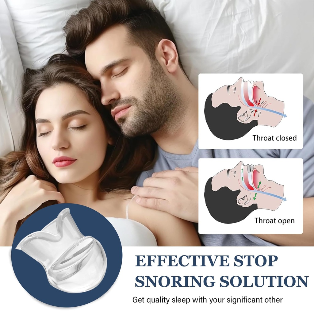 tongue-stabilizing-device-mouthpiece-ant-3.jpg