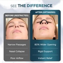 kira-reusable-nasal-breathing-support-st-5.jpg