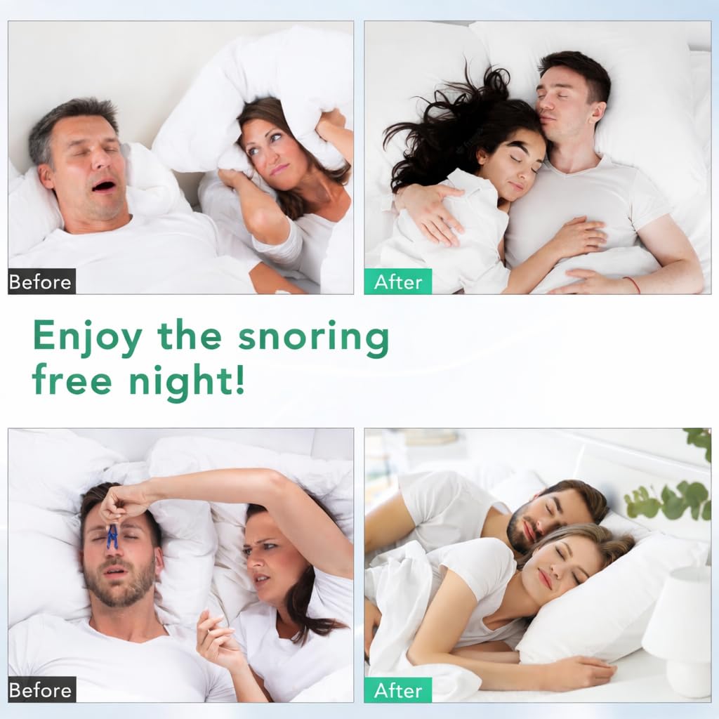 cinwauvo-anti-snoring-nose-vent-8-nasal--5.jpg