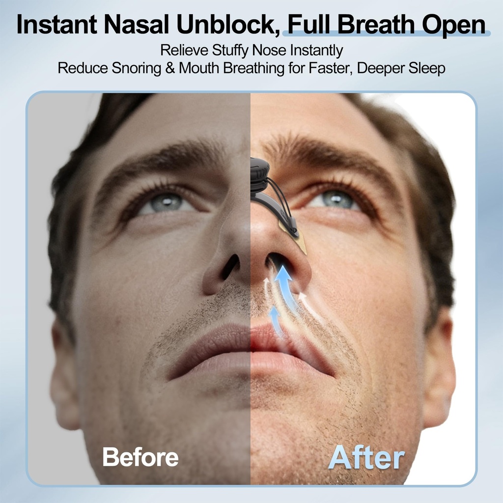 extra-strength-adjustable-nose-strips-fo-2.jpg