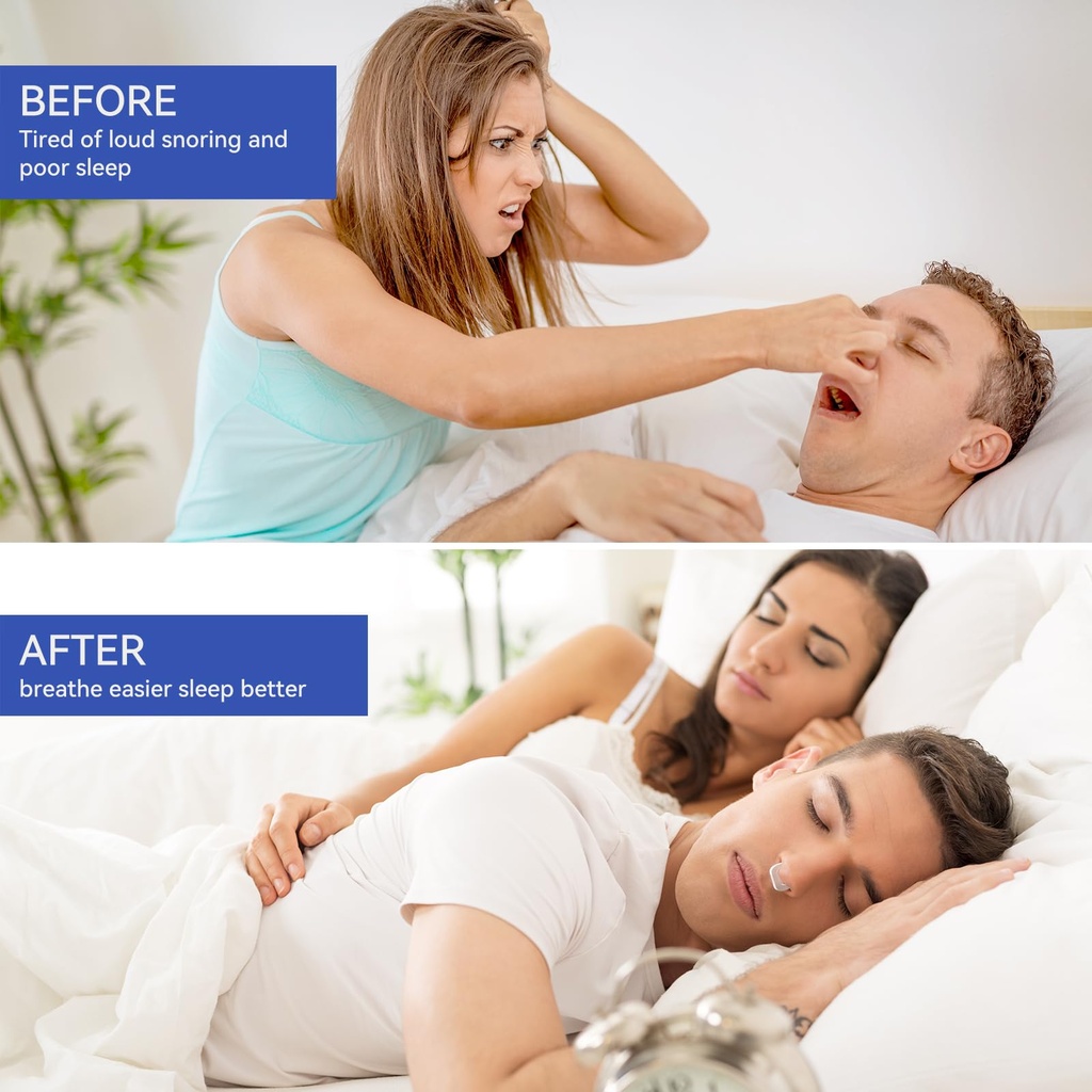 anti-snoring-devices-anngola-snoring-sol-5.jpg