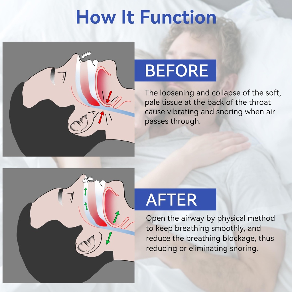 anti-snoring-devices-anskysea-snoring-so-3.jpg