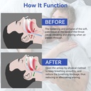 anti-snoring-devices-anskysea-snoring-so-3.jpg
