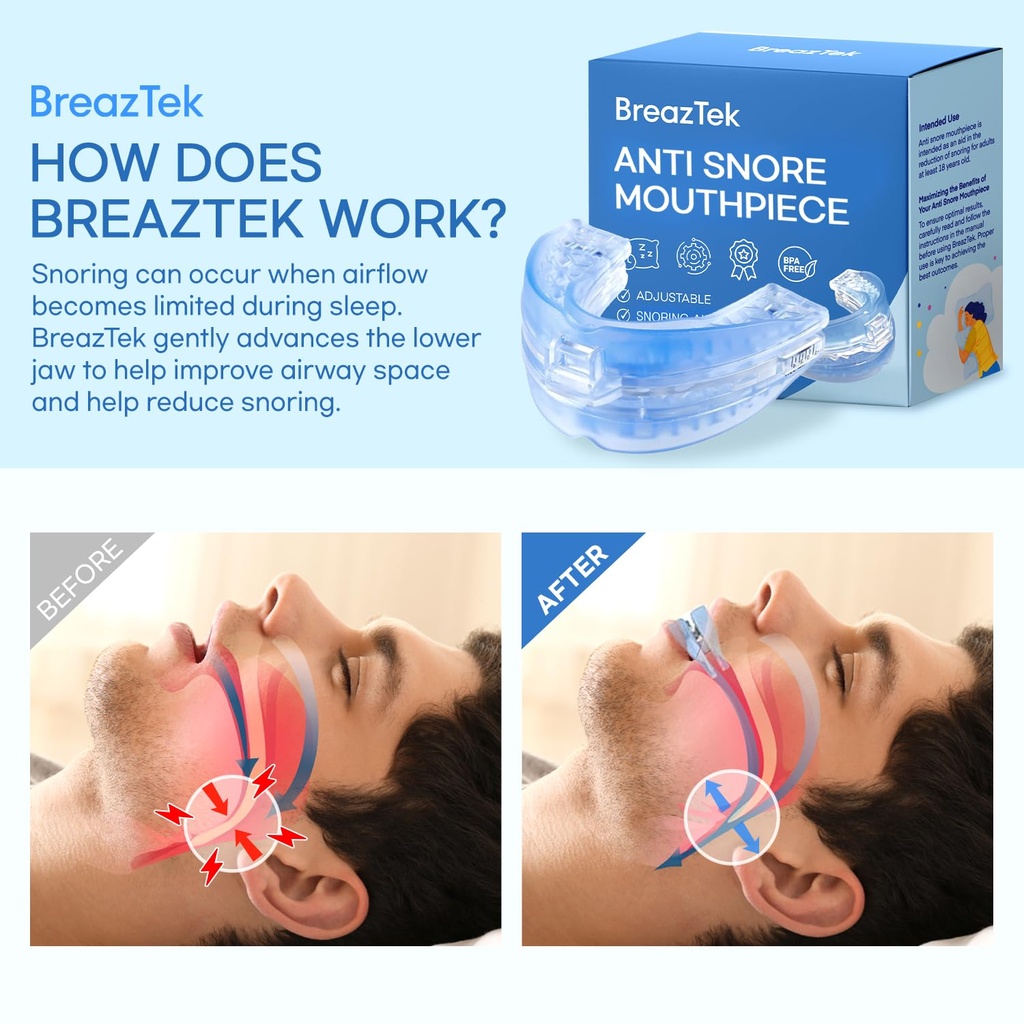 anti-snore-mouthpiece-fda-cleared-snorin-4.jpg