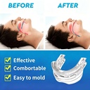 anti-snoring-mouthpiece-sleeping-aid-com-5.jpg