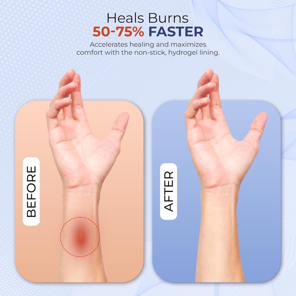 burnfix-burn-kit-first-aid-recommended-b-3.jpg