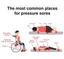 triderma-md-pressure-sore-relief-healing-4.jpg