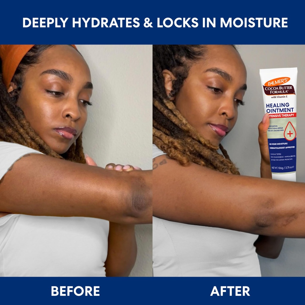palmer-s-healing-ointment-cocoa-butter-f-4.jpg