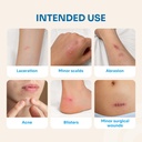 conkote-hydrocolloid-wound-dressings-4-x-5.jpg