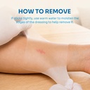 conkote-hydrocolloid-wound-dressings-4-x-6.jpg