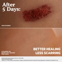 band-aid-brand-pro-heal-5-day-protect-hy-6.jpg