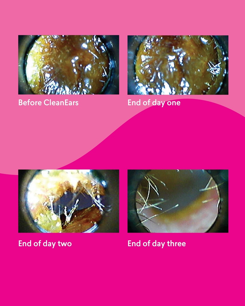 clean-ears-ear-wax-removal-spray-clean-e-5.jpg