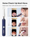bebird-earsight-plus-r37r-ear-wax-remova-6.jpg