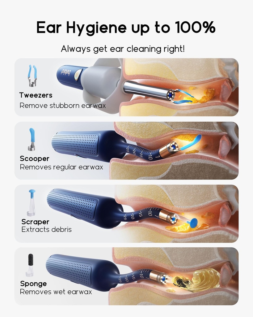 bebird-earsight-plus-r37r-ear-wax-remova-4.jpg