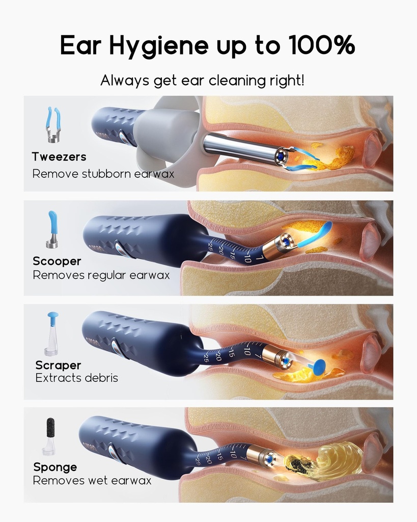 bebird-earsight-plus-d39r-ear-wax-remova-5.jpg