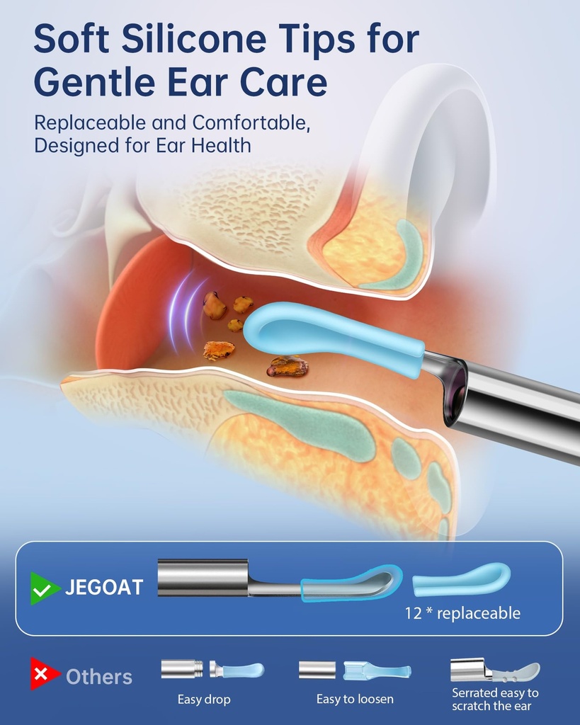 jegoat-ear-wax-removal-tool-camera-1296p-2.jpg