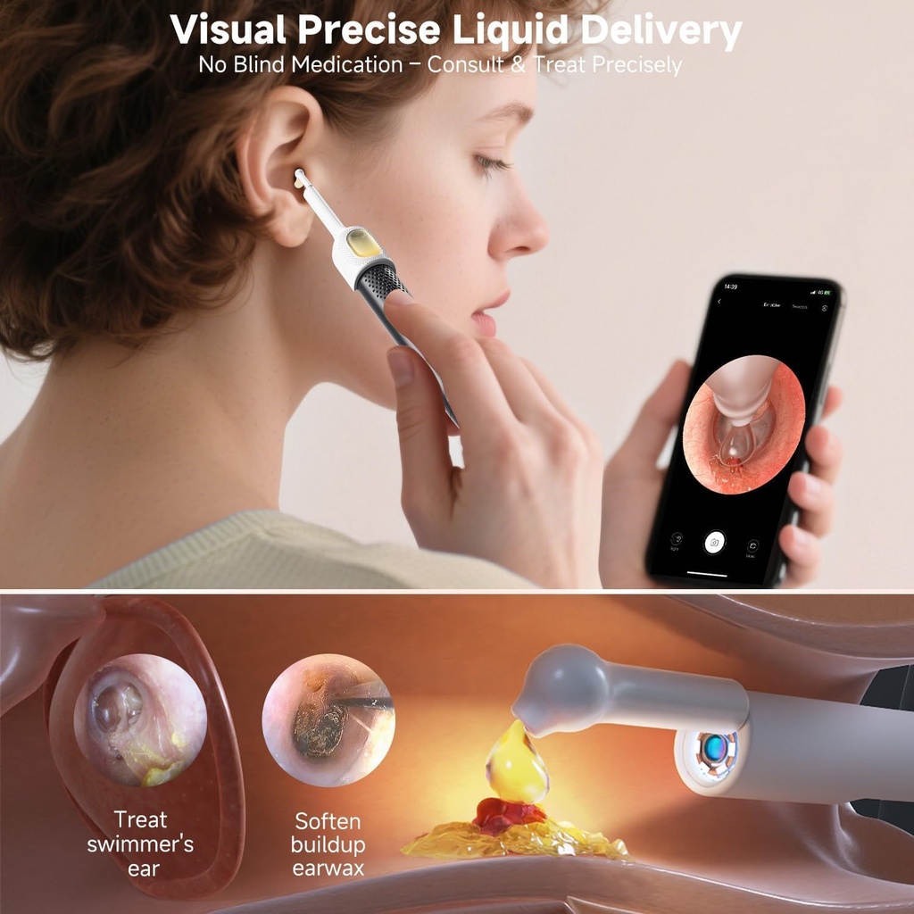 bebird-r1-ultra-ear-wax-removal-tweezers-6.jpg