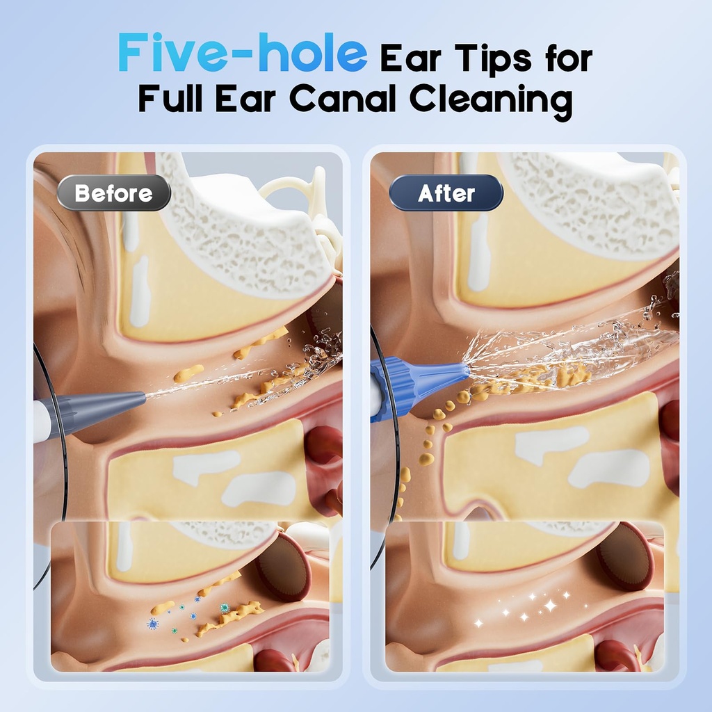ear-irrigation-flushing-system-for-adult-4.jpg
