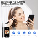 high-definition-ear-wax-removal-wireless-3.jpg