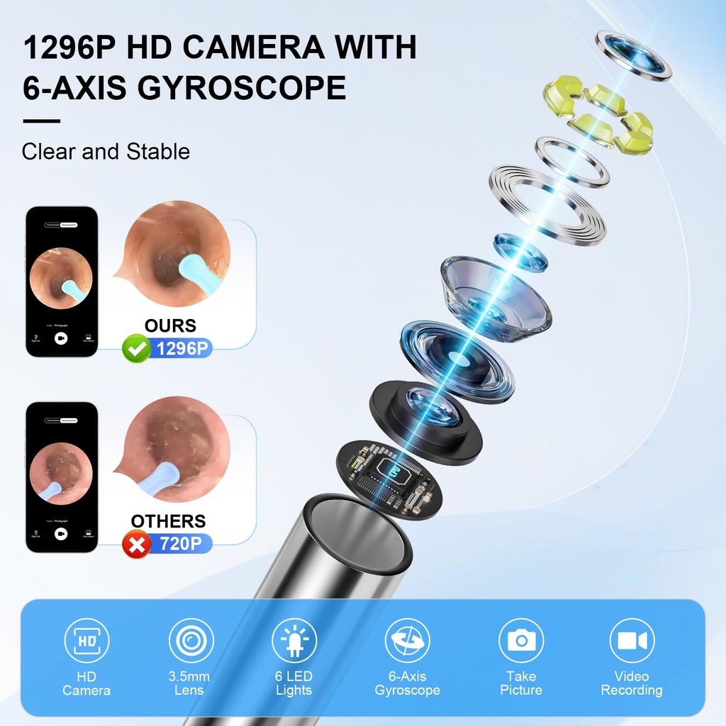 high-definition-ear-wax-removal-wireless-2.jpg
