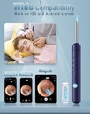 ear-wax-removal-ear-cleaner-with-camera--6.jpg