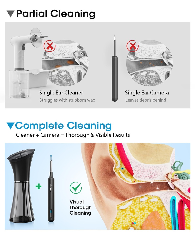 ear-cleaner-with-camera-irrigation-wax-r-3.jpg