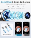 ear-cleaner-with-camera-irrigation-wax-r-5.jpg