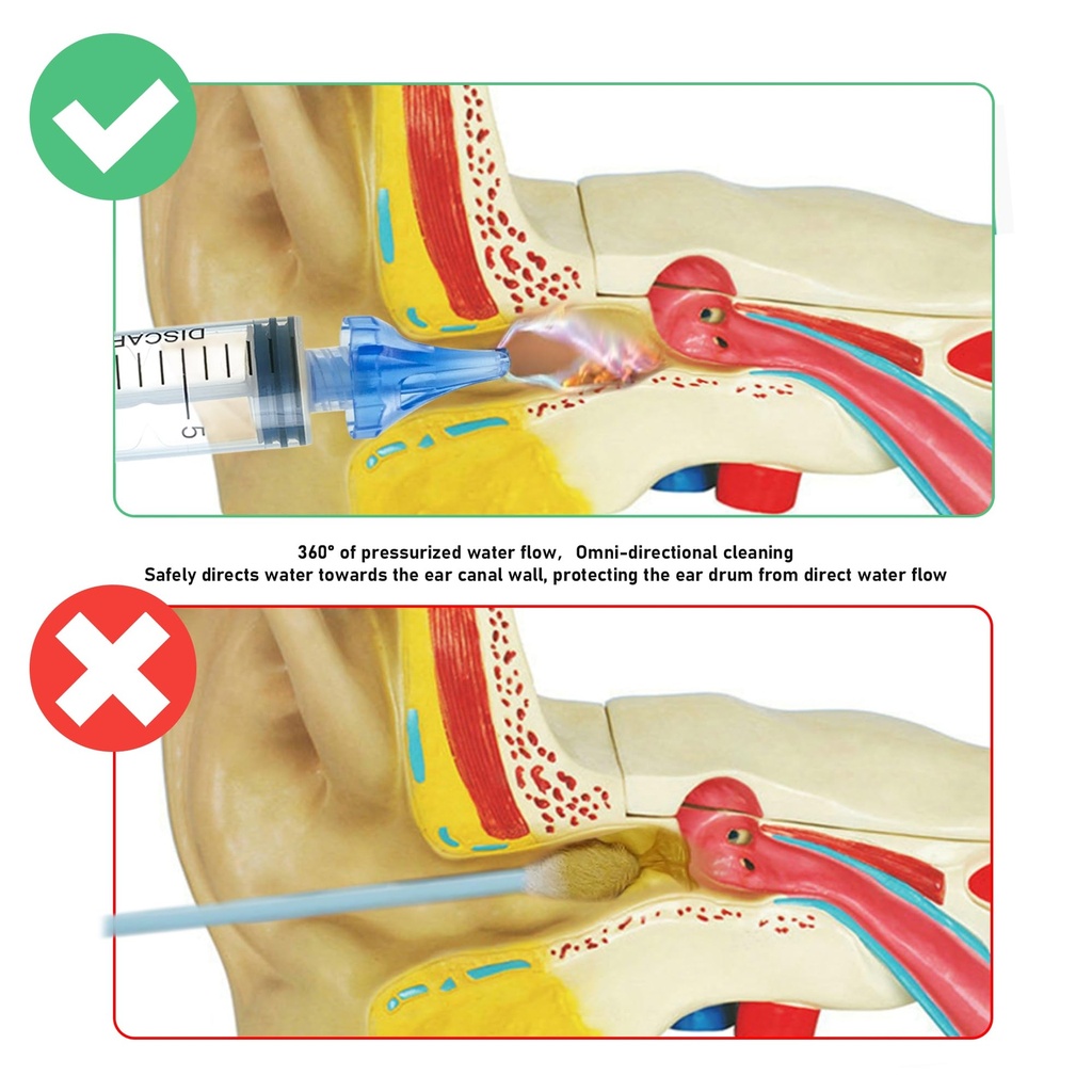20ml-ear-syringes-for-removing-ear-wax-c-2.jpg