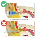 20ml-ear-syringes-for-removing-ear-wax-c-2.jpg