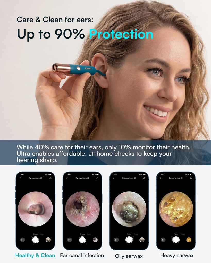 bebird-earsight-ultra-ear-wax-removal-to-3.jpg