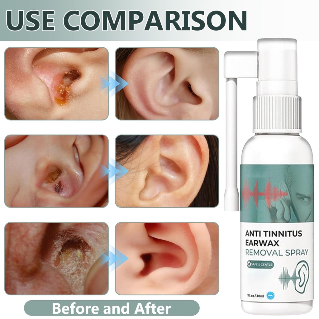 hearing-restoration-spray-anti-tinnitus--3.jpg