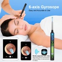 ear-wax-removal-with-camera-earwax-remov-4.jpg