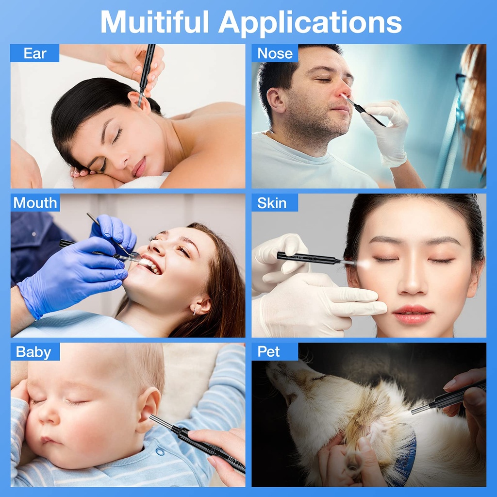 ear-wax-removal-with-camera-earwax-remov-6.jpg
