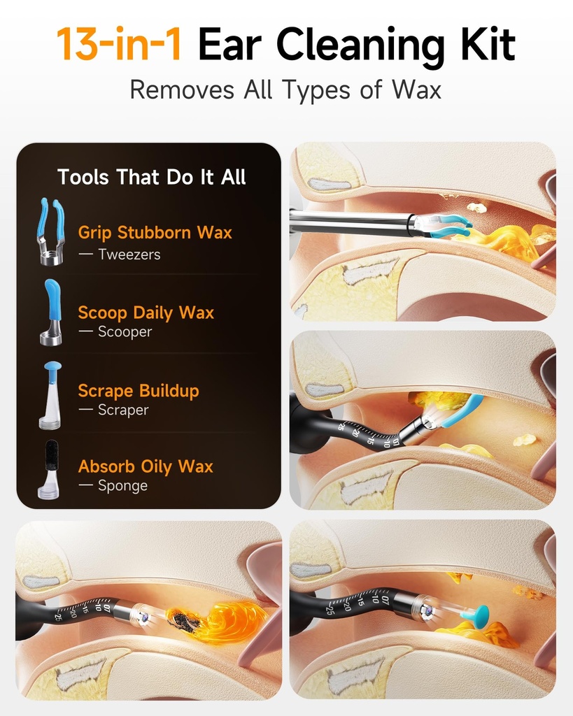 flexible-ear-wax-removal-tool-camera-wir-4.jpg