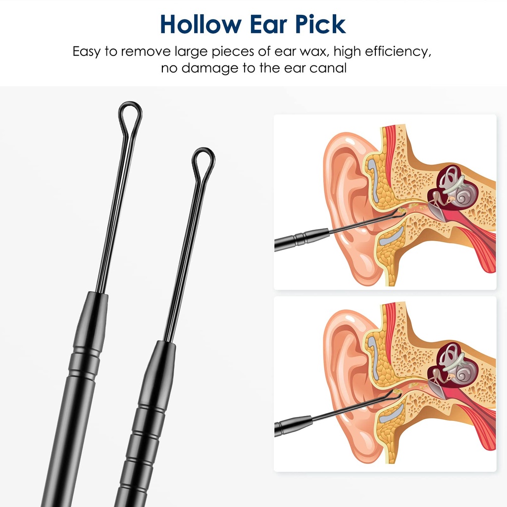 ear-wax-removal-kit-ear-wax-cleaner-ear--3.jpg