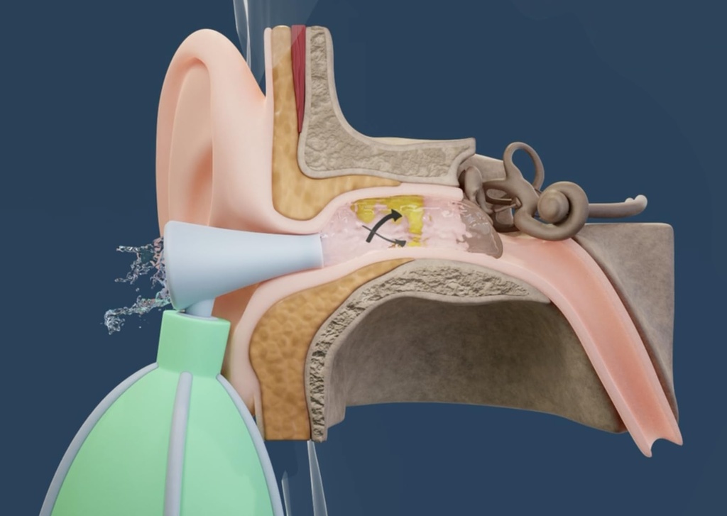 the-swirly-ear-ear-wax-removal-and-ear-c-5.jpg