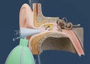 the-swirly-ear-ear-wax-removal-and-ear-c-5.jpg